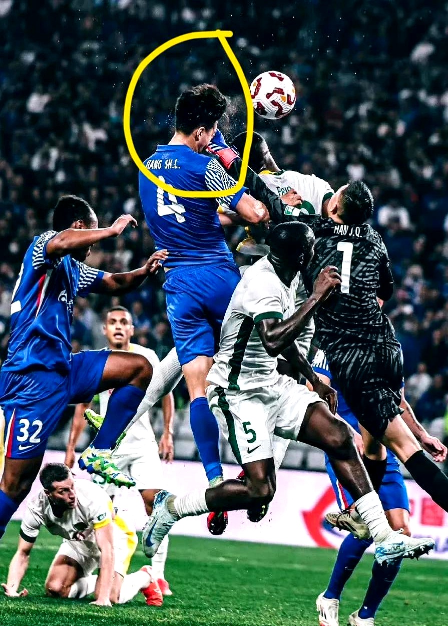 明星球员受伤缺席,球队战斗力大幅下降的简单介绍 明星球员受伤缺席,球队战斗力大幅下降的简单介绍